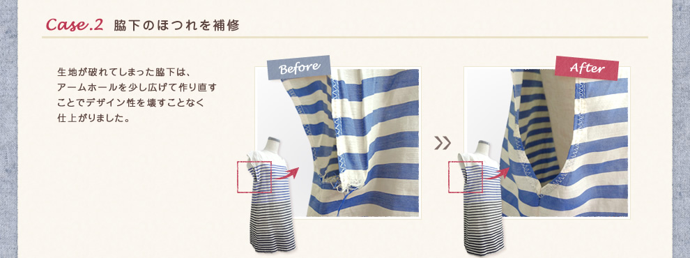 Case.2 脇下のほつれを補修